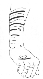 Zeichnung vom tätowierten Unterarm einer 1600 Jahre alten gefrorenen Mumie aus Saint Lawrence Island, Alaska © George S. Smith, National Park Service. In: Michael R. Zimmerman, Alaskan and Aleutian Mummies